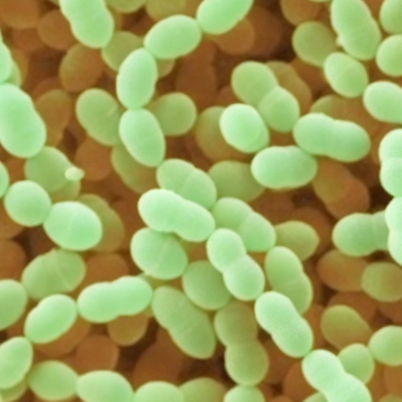 Lactococcus lactis subsp. lactis